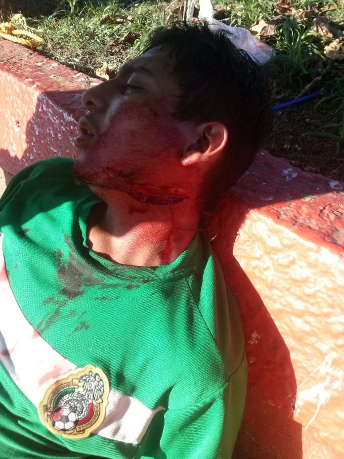 lesionado1-1