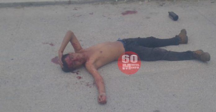 Alcohólico sufre caída en Tepito