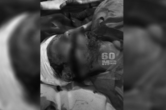 Asesinan a machetazos a delegado municipal en Huimanguillo