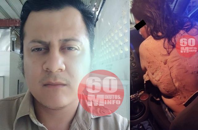 Buscan a José por golpear y arrojar aceite hirviendo a su pareja