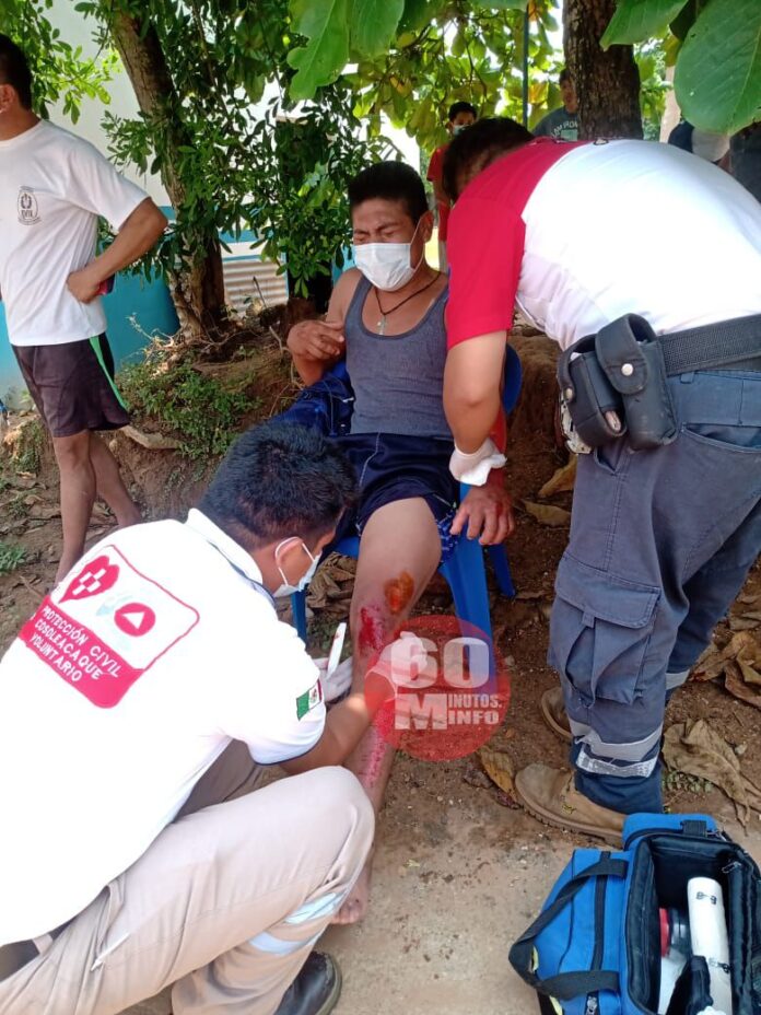 Motociclista acaba con múltiples lesiones por exceso de velocidad