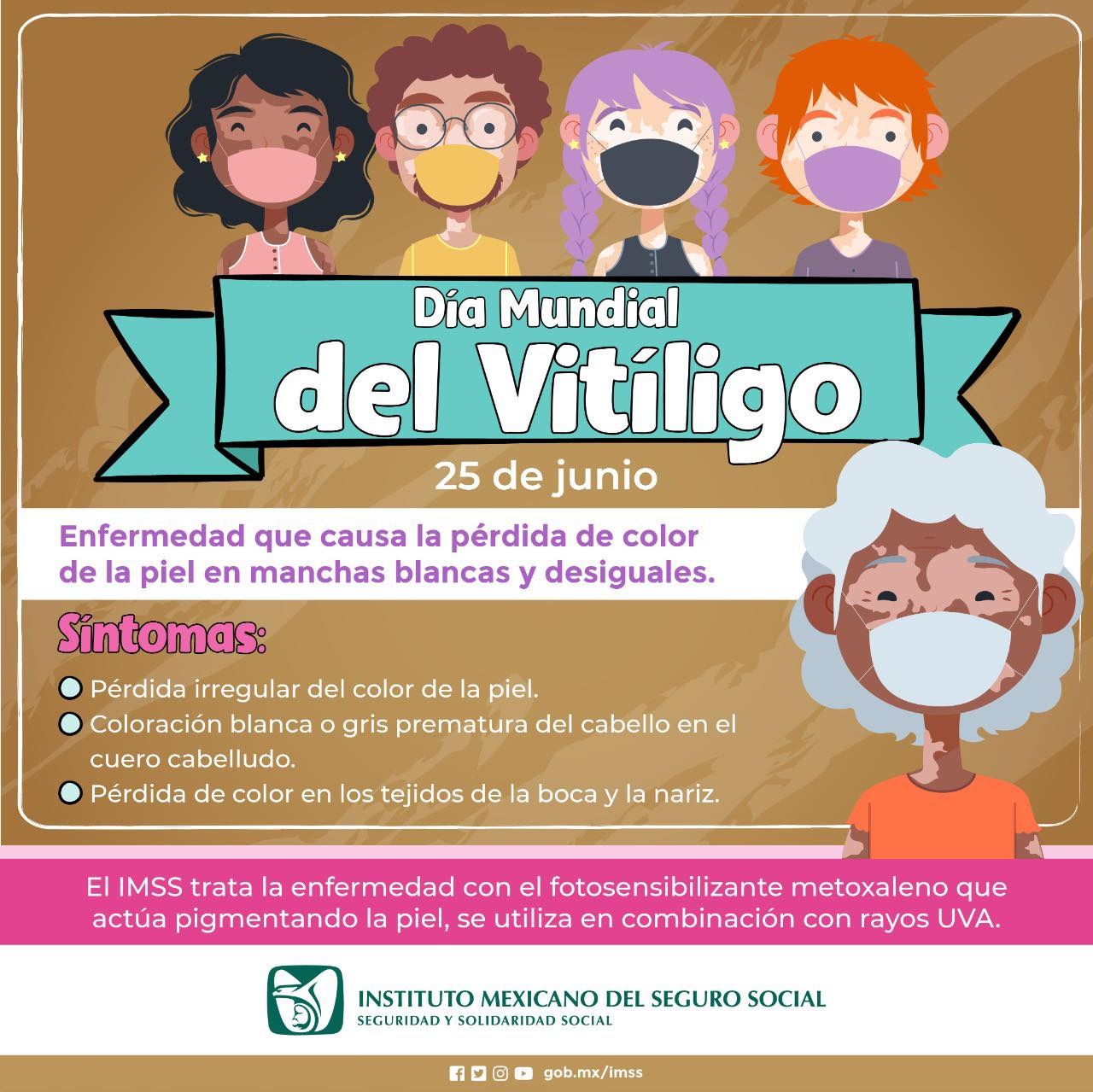 Explica Imss Veracruz Sur Sobre Vit Ligo Minutos