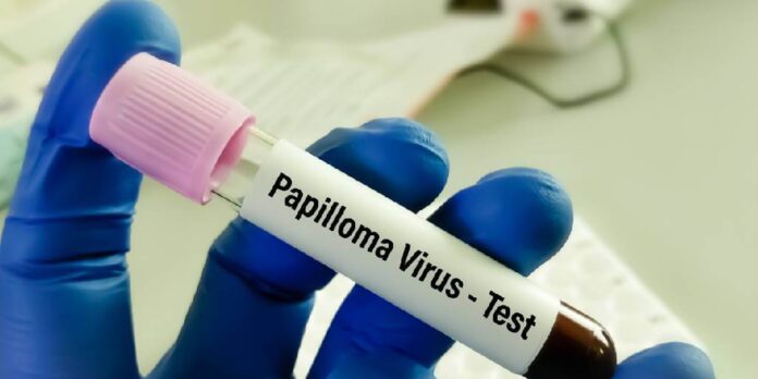 Pruebas-de-VPH